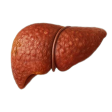 Toxin Buildup