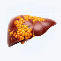 Cleanses & Detoxes the Liver